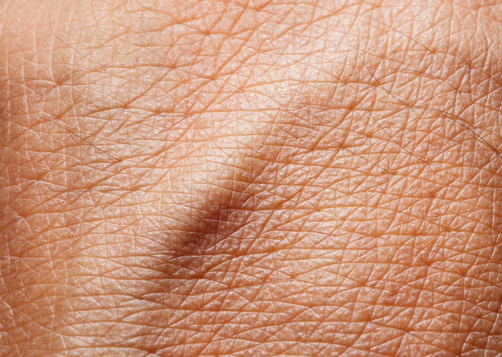 close up of human skin