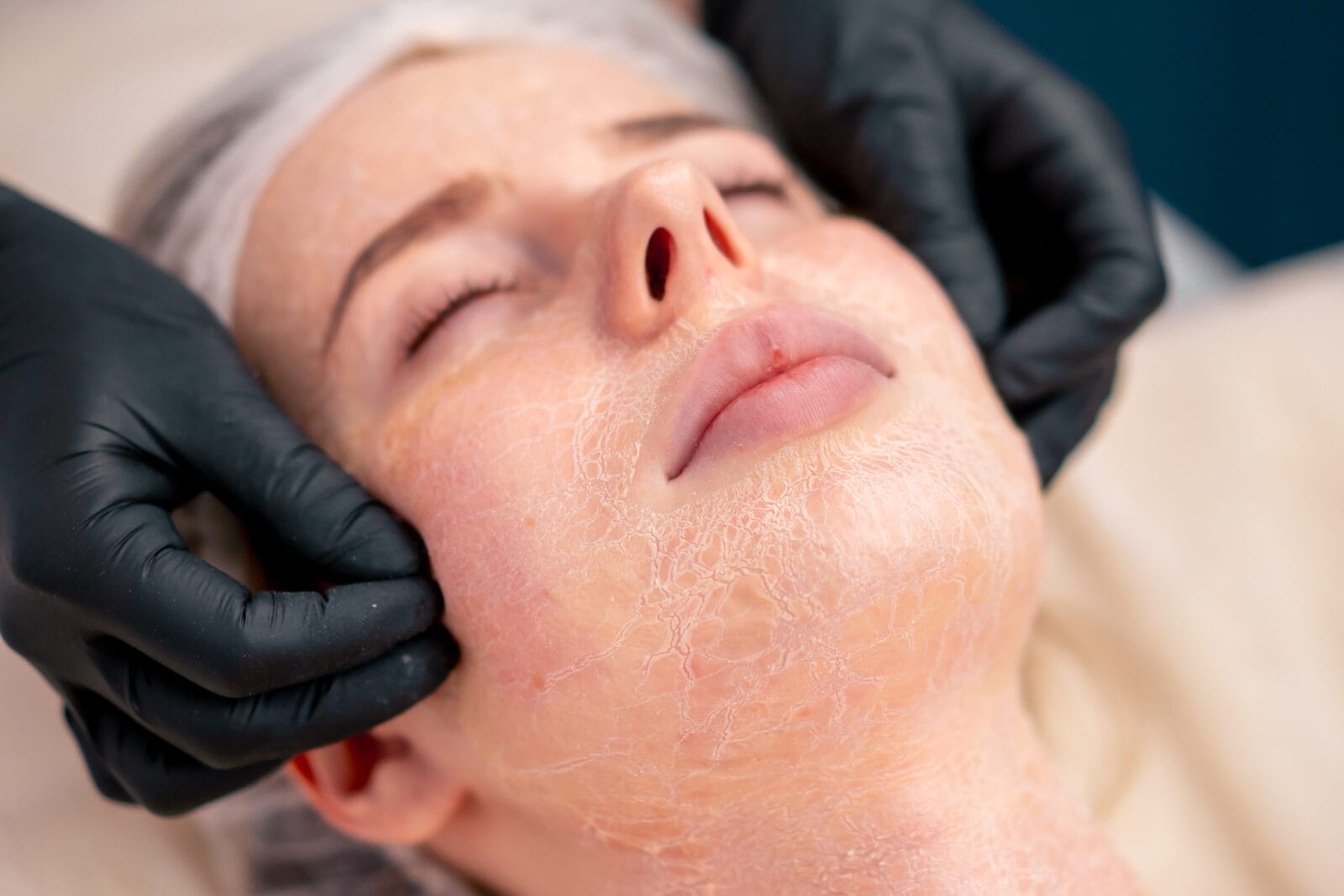 close up beautician in gloves rubs the serum with massage movements on the face of a client in salon